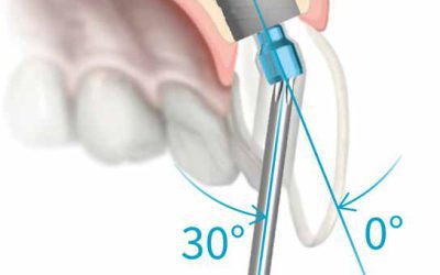 INCLINED HOLE TECHNOLOGY